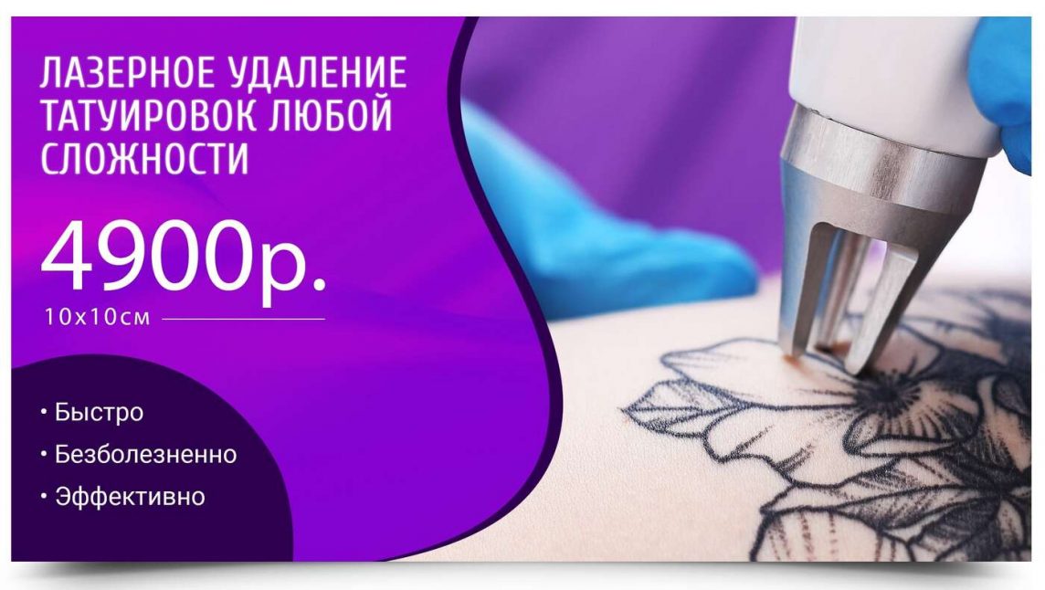 удаление татуировок